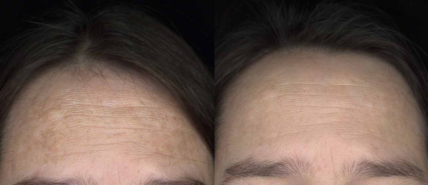 GLOW PIGMENTATION KIT DELUXE